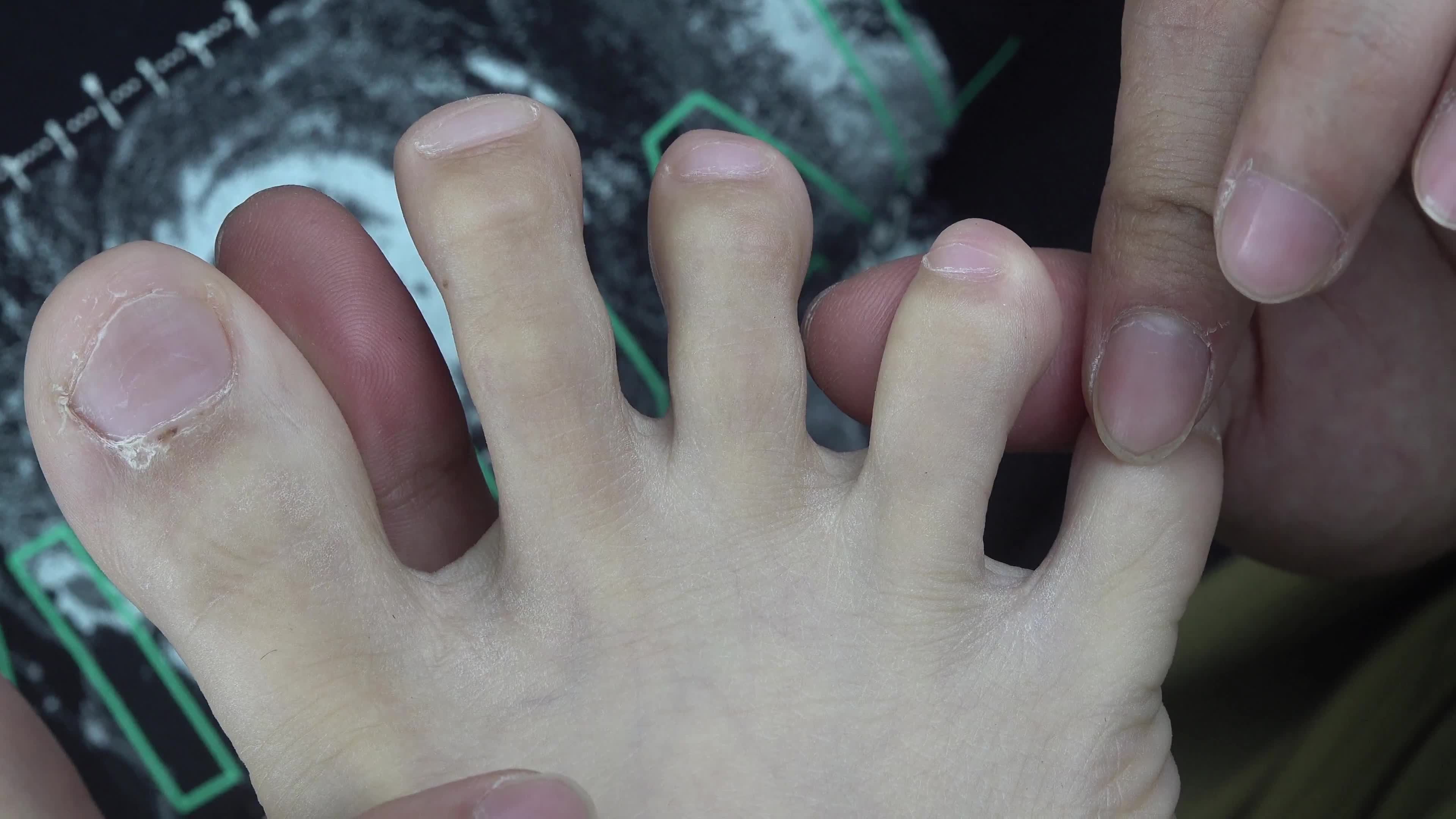 图片[5]-南国足艺视频_NO.035_清纯小雪害羞脱白袜_近距离秀脚_1V_3.89G-丽丝屋